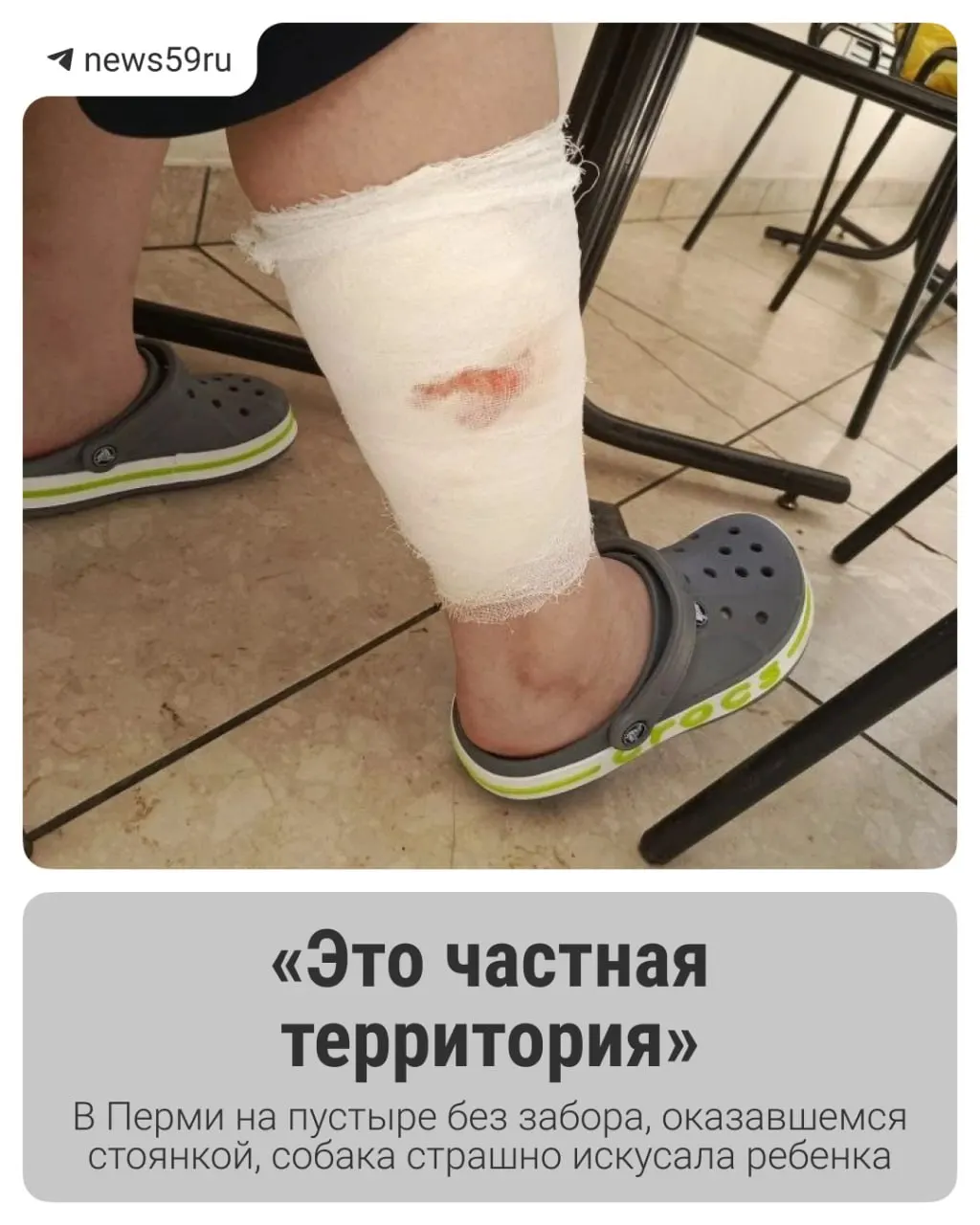 На неогороженной стоянке рядом с продуктовым магазином в Перми собака напала на школьника. Мальчика госпитализировали с рваными ранами ног, мать обратилась в полицию, хозяин собаки отрицает вину и не оказал помощь.