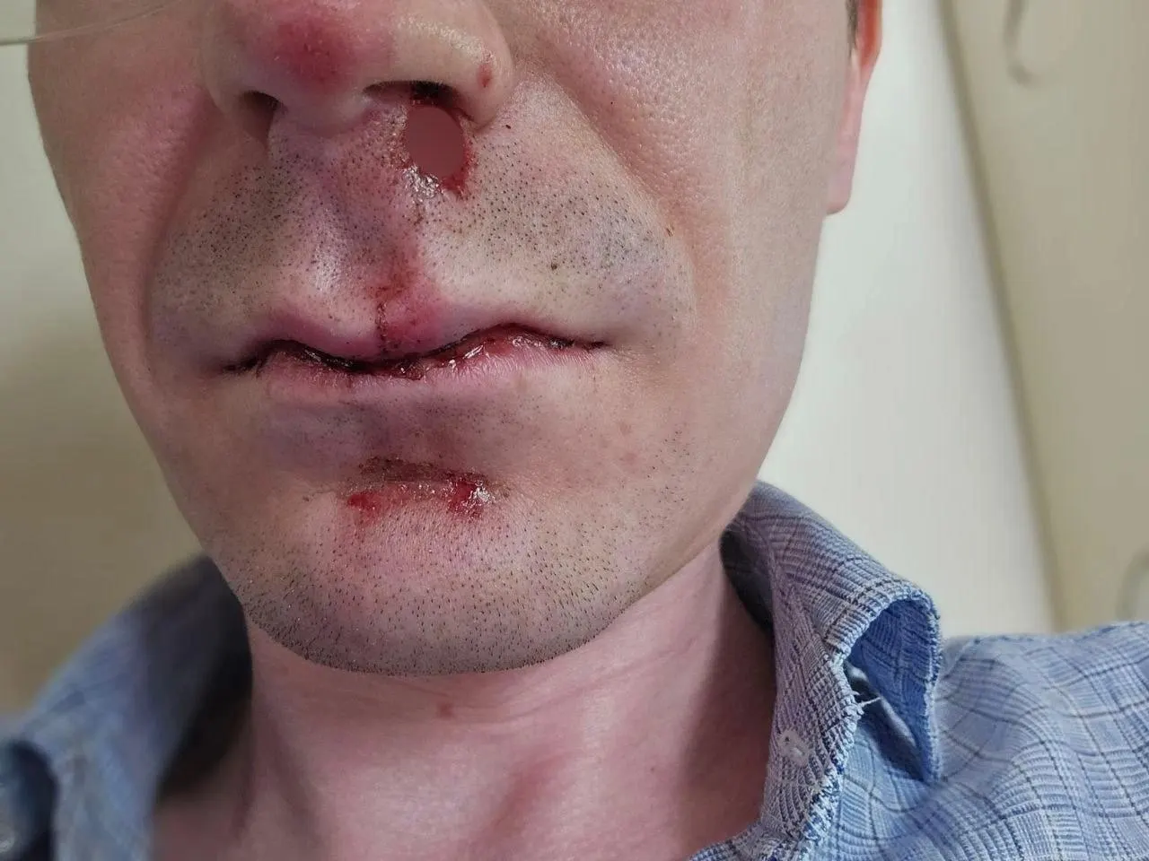 Утром 14 июня в центре Перми группа подростков напала на двух мужчин. Одного из подозреваемых отправили в Центр временного содержания для несовершеннолетних правонарушителей, в отношении других составлены административные протоколы, возбуждено уголовное дело.