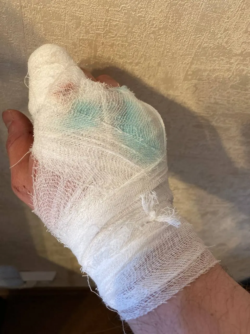 Рано утром у перекрёстка Революции и Островского двое пермяков пострадали в результате нападения пятерых–семерых подростков; пострадавшие получили медицинскую помощь, полиция проводит проверку.